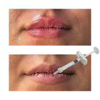 Aglomerante cutáneo de ácido hialurónico inyectable Aglomerantes para mejorar los labios