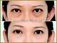 Llenadores cutáneos faciales ácidos hialurónicos para el círculo de relleno del ojo del canal del rasgón