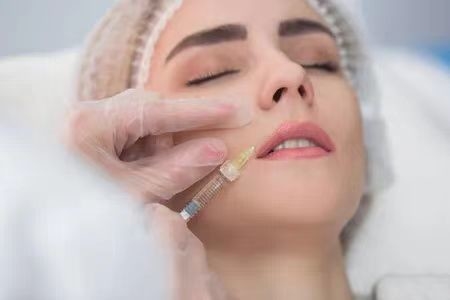 Envase de la jeringa Ácido hialurónico para arrugas Relleno nasal, gel de ácido hialurónico para inyección