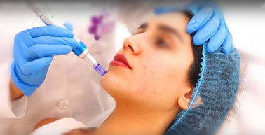 llenador cutáneo ligado no cruzado ha antienvejecedora de 20mg/Ml ha para la pluma de Hyaluron