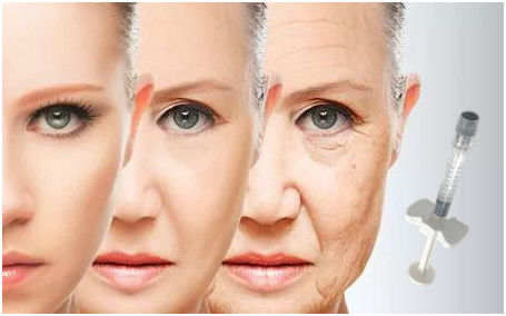 Llenador ácido hialurónico 24mg/Ml de la cara para los pies de cuervos de las depresiones de la mejilla