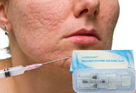 llenador cutáneo ácido hialurónico inyectable 10ml para corregir asimetría facial