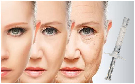 Cuidado de piel cutáneo del llenador del lifting facial PCL que levanta apretando el colágeno estimulante