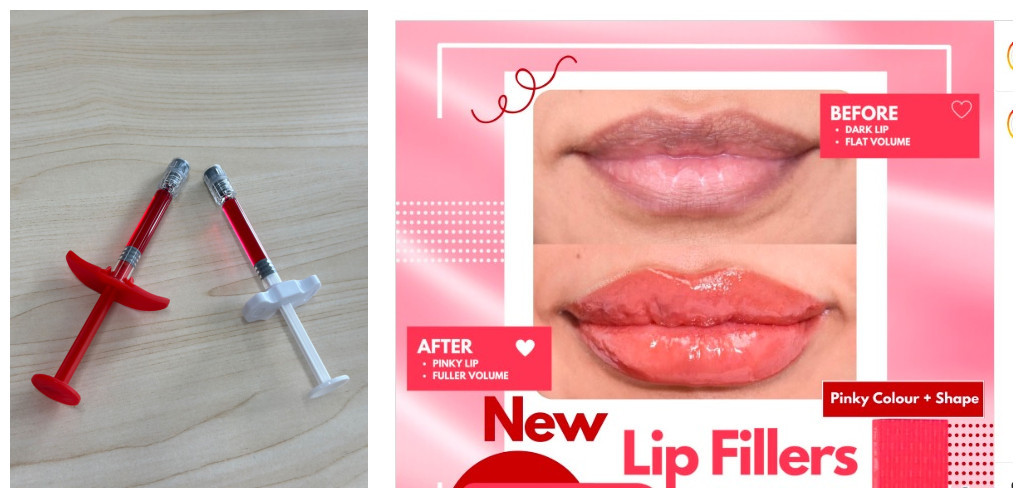 Relleno de labios cutáneo seguro y eficaz para los profesionales médicos