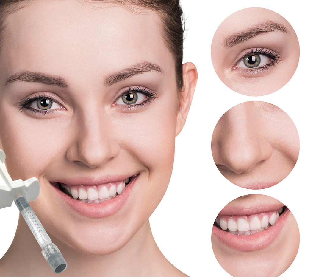 la cruz cutánea de los llenadores del labio 1ml ligó el sodio Hyaluronate para la rinoplastia