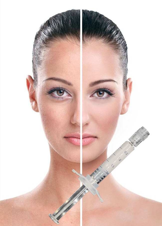 Cuidado de piel cutáneo del llenador del lifting facial PCL que levanta apretando el colágeno estimulante