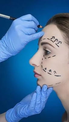Limpia las arrugas y define la línea de la mandíbula con rellenos dérmicos faciales 70% HA Cruzado 24 mg 30% Calcio hidroxilapatita