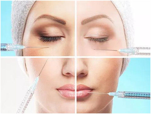 Relleno dérmico estéril de ácido hialurónico reticulado diseñado para el contorno facial de aspecto natural y el rejuvenecimiento de la piel
