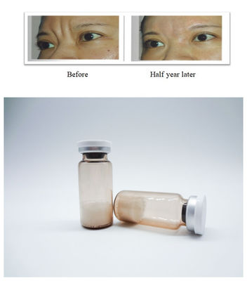 Gel inyectable para la piel facial no animal Acido hialurónico basado para el tratamiento seguro de arrugas y restauración del volumen